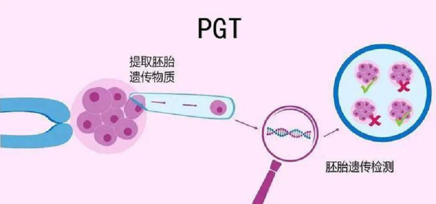 去墨西哥做试管婴儿停留时间如何规划?